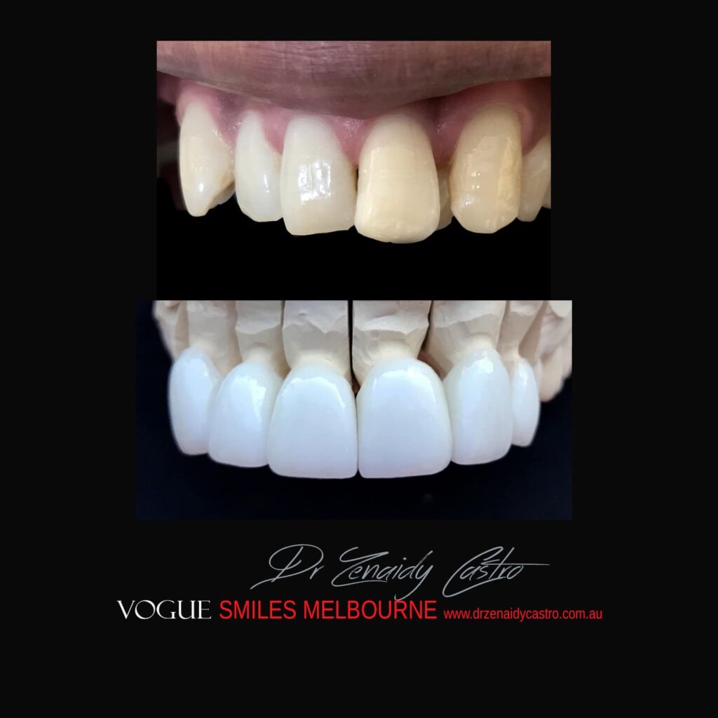 VOGUE-SMILES-COSMETIC-DENTISTRY-TREATMENT
