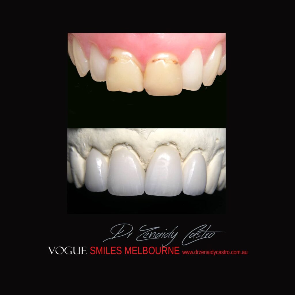 VOGUE-SMILES-COSMETIC-DENTISTRY-TREATMENT