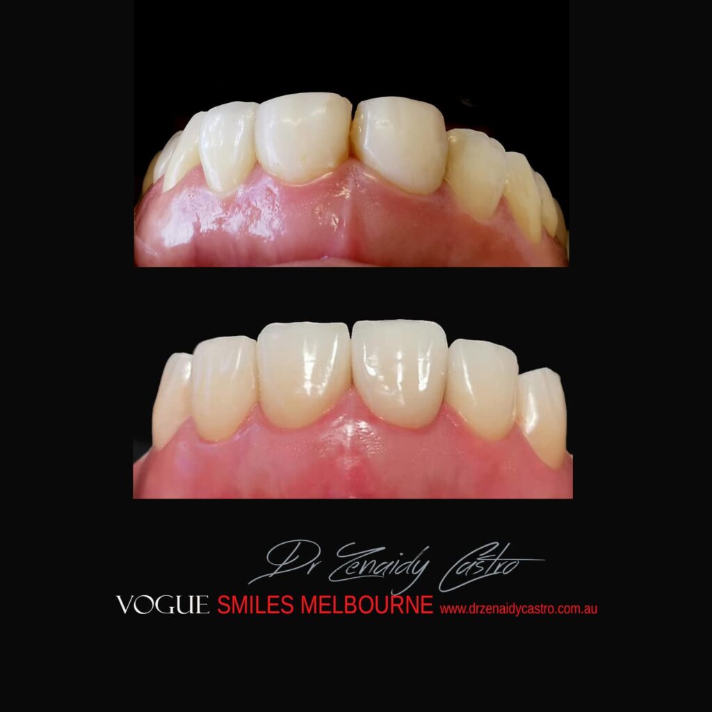 VOGUE-SMILES-COSMETIC-DENTISTRY-TREATMENT