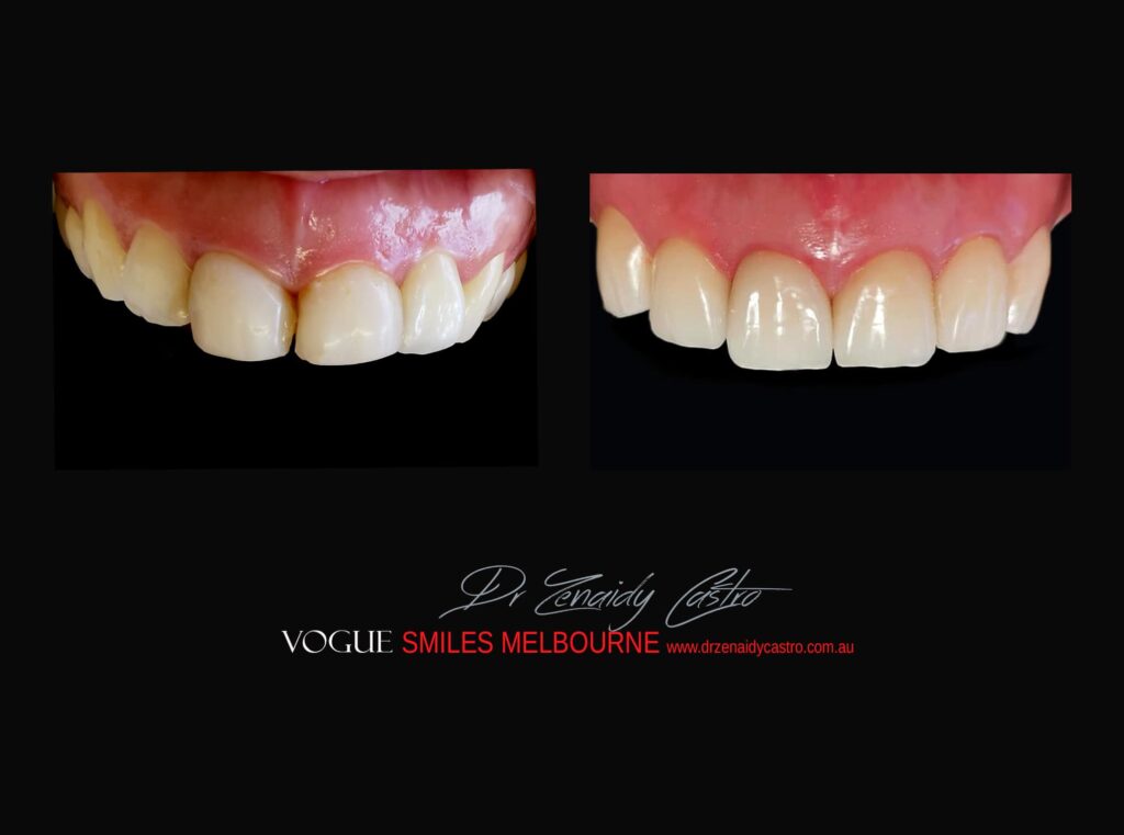 VOGUE-SMILES-COSMETIC-DENTISTRY-TREATMENT