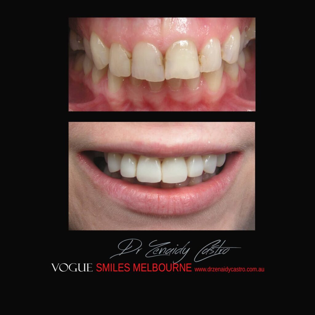 VOGUE-SMILES-COSMETIC-DENTISTRY-TREATMENT