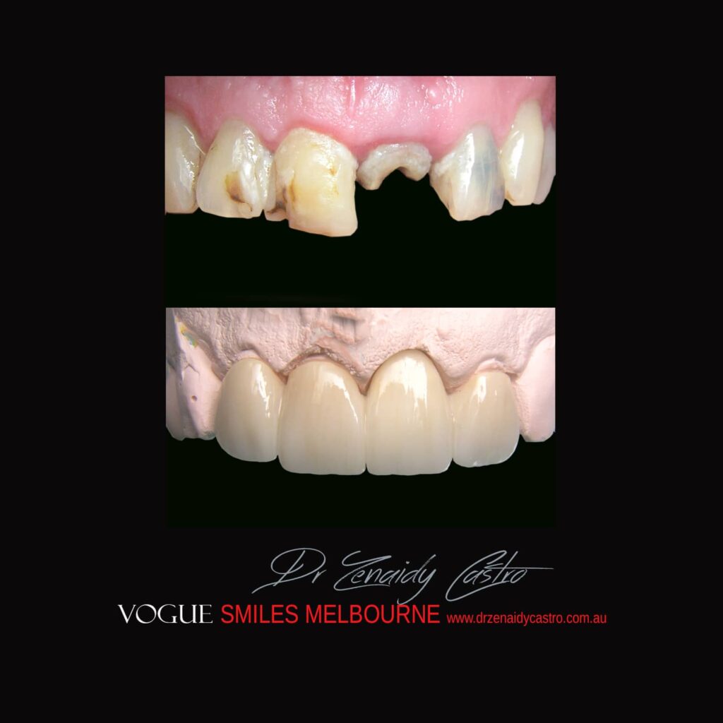 VOGUE-SMILES-COSMETIC-DENTISTRY-TREATMENT
