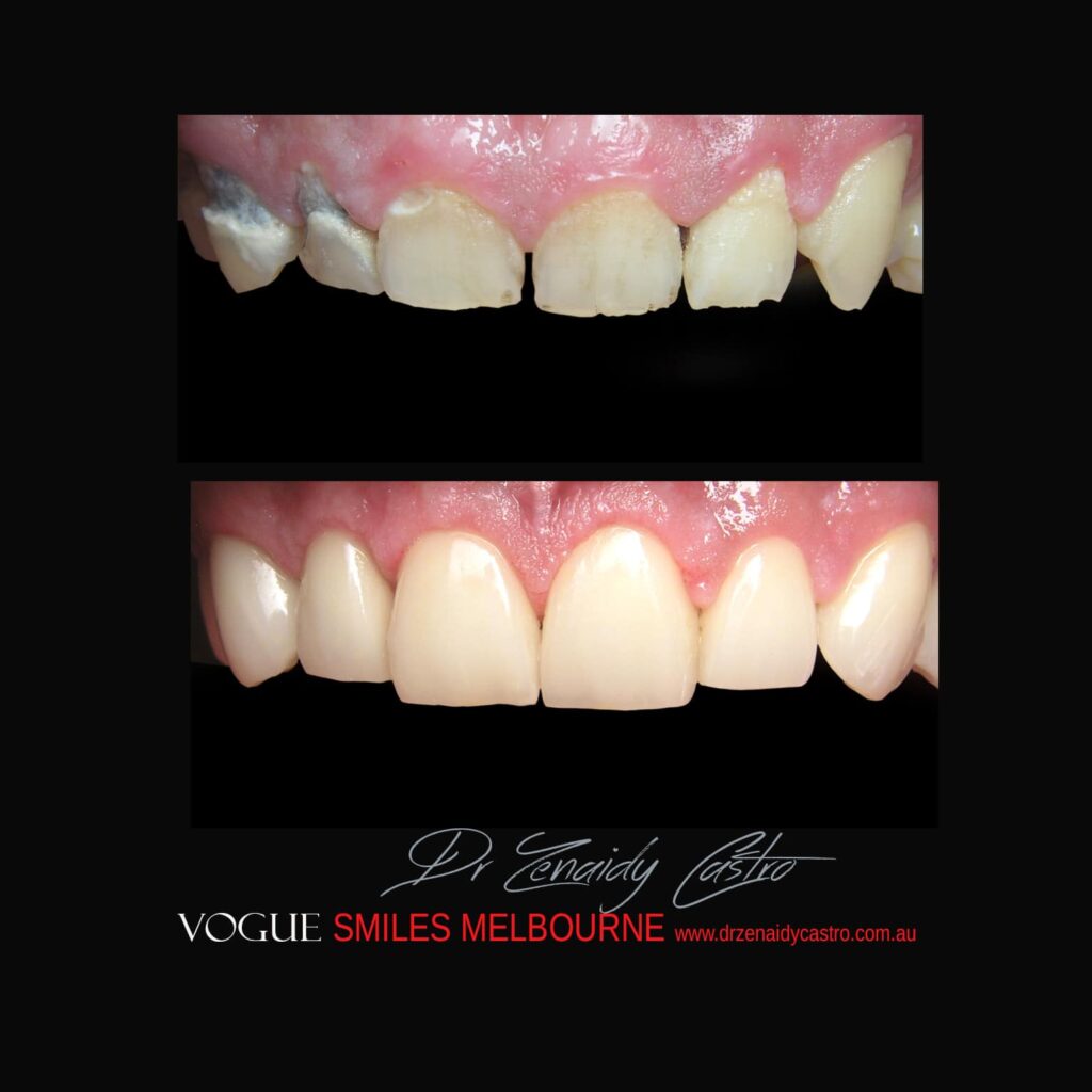 VOGUE-SMILES-COSMETIC-DENTISTRY-TREATMENT