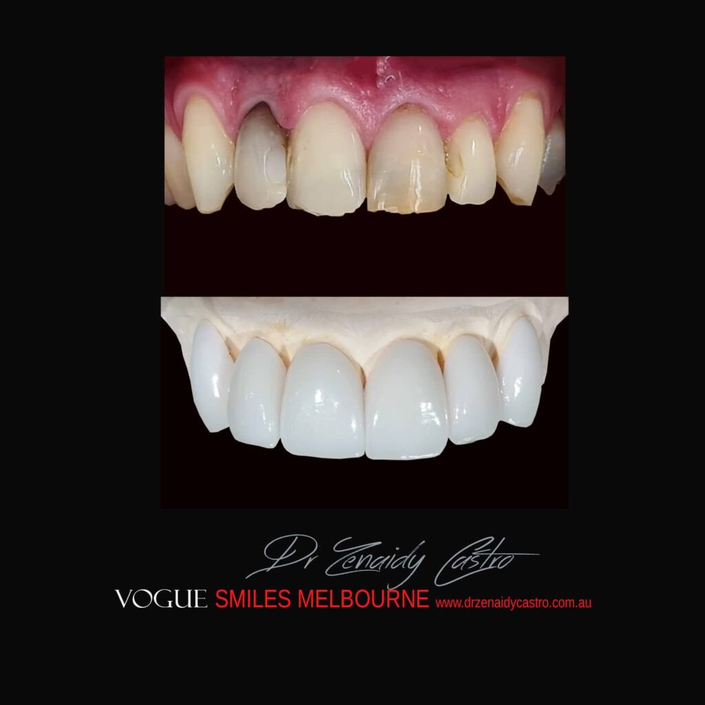 VOGUE-SMILES-COSMETIC-DENTISTRY-TREATMENT