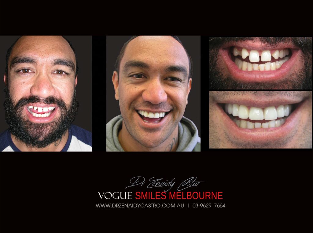VOGUE-SMILES-COSMETIC-DENTISTRY
