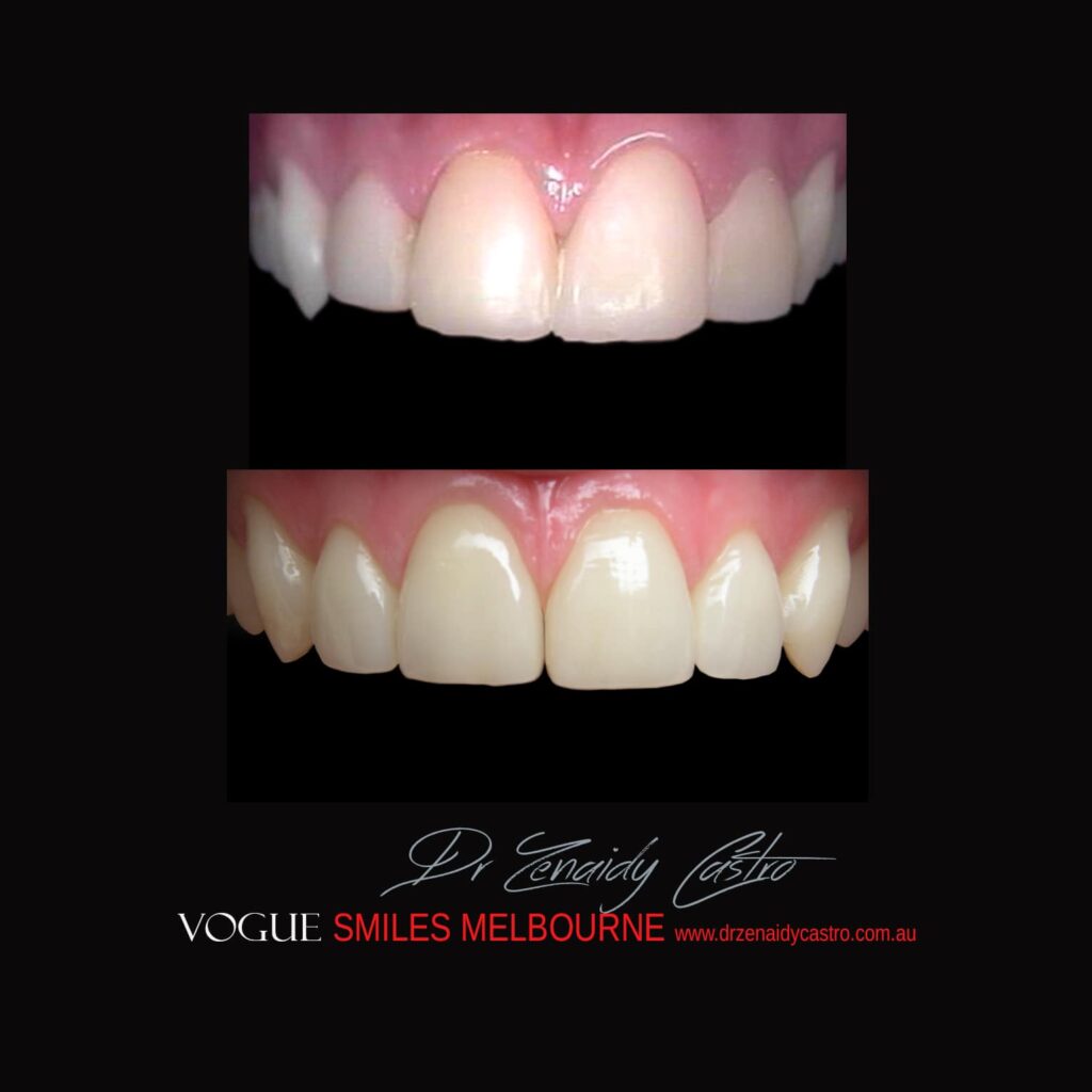VOGUE-SMILES-COSMETIC-DENTISTRY-TREATMENT