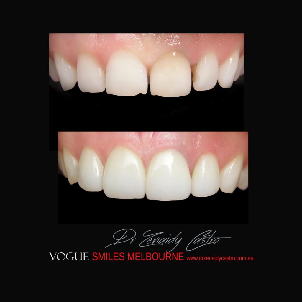 VOGUE-SMILES-COSMETIC-DENTISTRY-TREATMENT