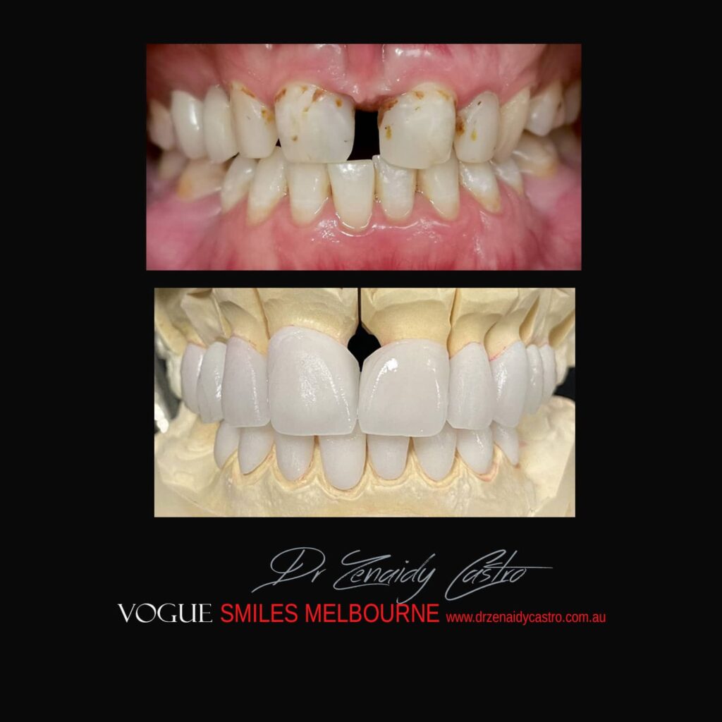 VOGUE-SMILES-COSMETIC-DENTISTRY-TREATMENT