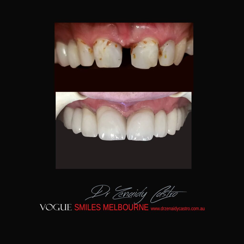 VOGUE-SMILES-COSMETIC-DENTISTRY-TREATMENT