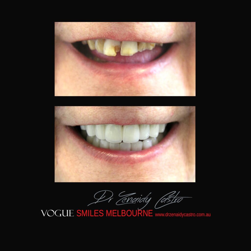 VOGUE-SMILES-COSMETIC-DENTISTRY-TREATMENT