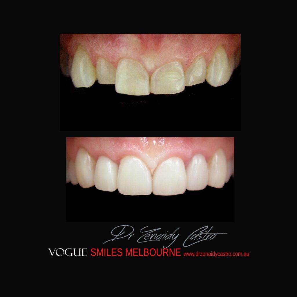 VOGUE-SMILES-COSMETIC-DENTISTRY-TREATMENT