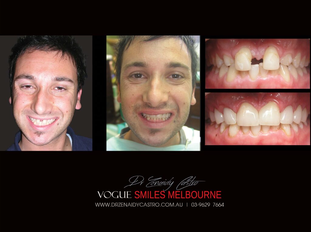 VOGUE-SMILES-COSMETIC-DENTISTRY