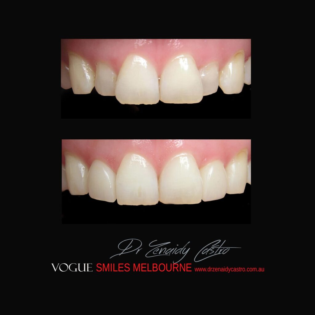 VOGUE-SMILES-COSMETIC-DENTISTRY-TREATMENT