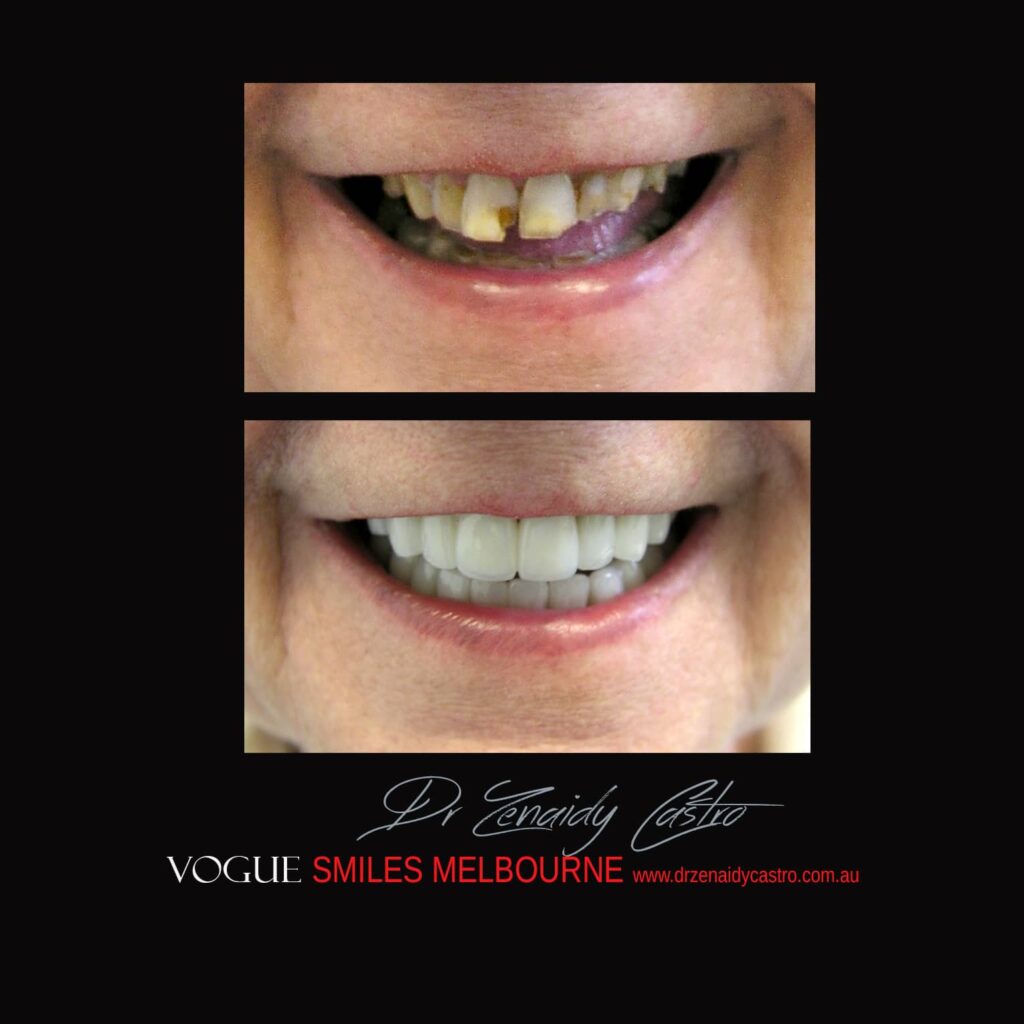 VOGUE-SMILES-COSMETIC-DENTISTRY-TREATMENT