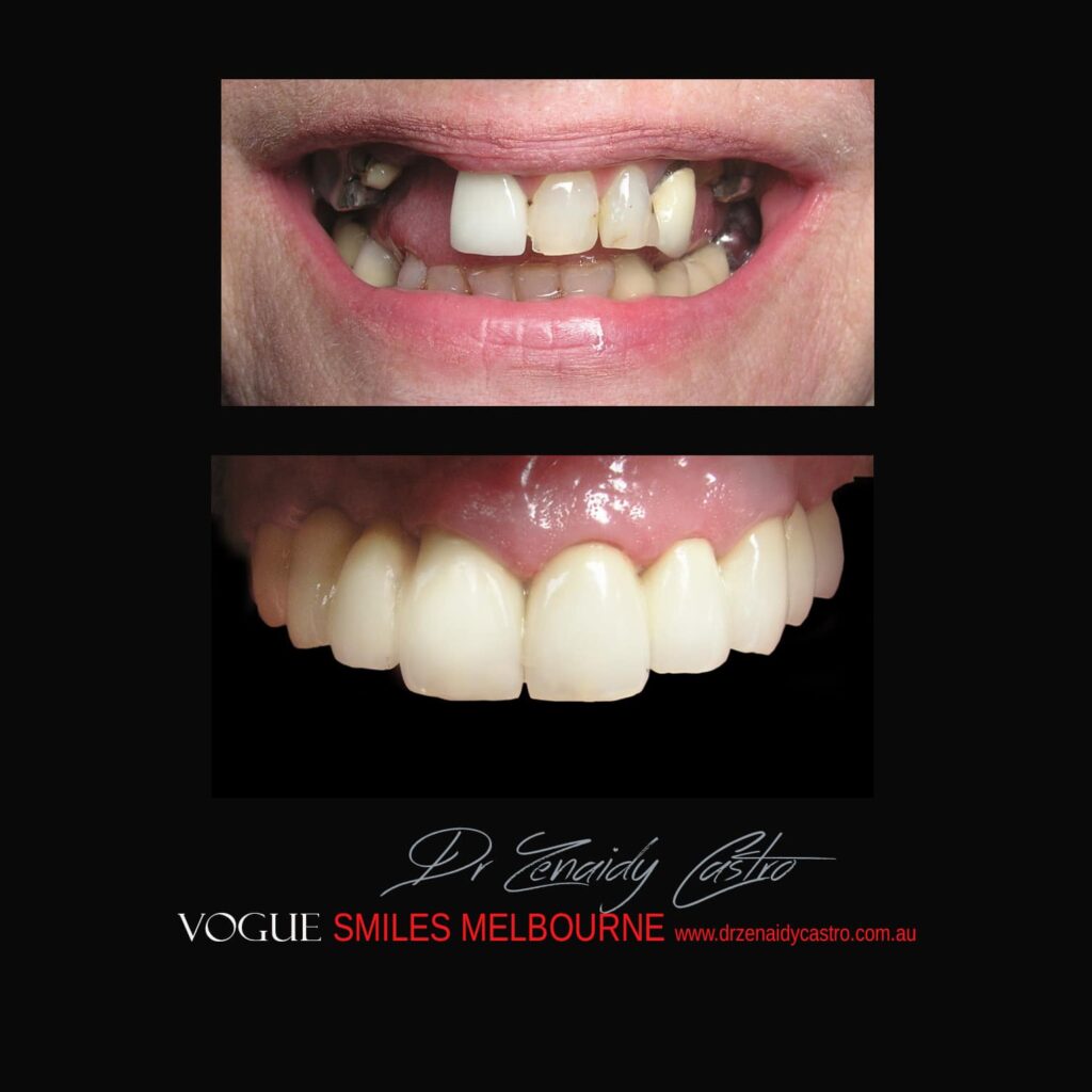 VOGUE-SMILES-COSMETIC-DENTISTRY-TREATMENT