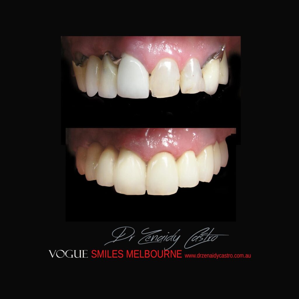 VOGUE-SMILES-COSMETIC-DENTISTRY-TREATMENT