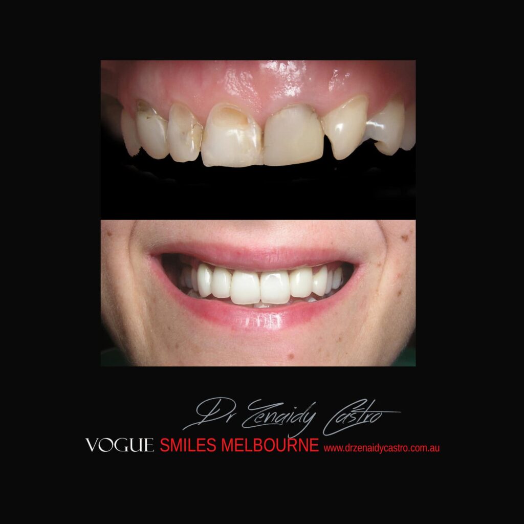 VOGUE-SMILES-COSMETIC-DENTISTRY-TREATMENT