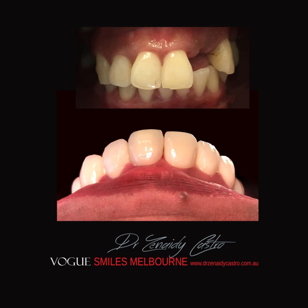 VOGUE-SMILES-COSMETIC-DENTISTRY-TREATMENT
