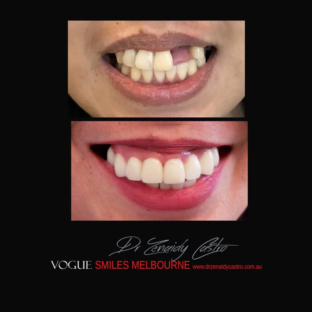 VOGUE-SMILES-COSMETIC-DENTISTRY-TREATMENT