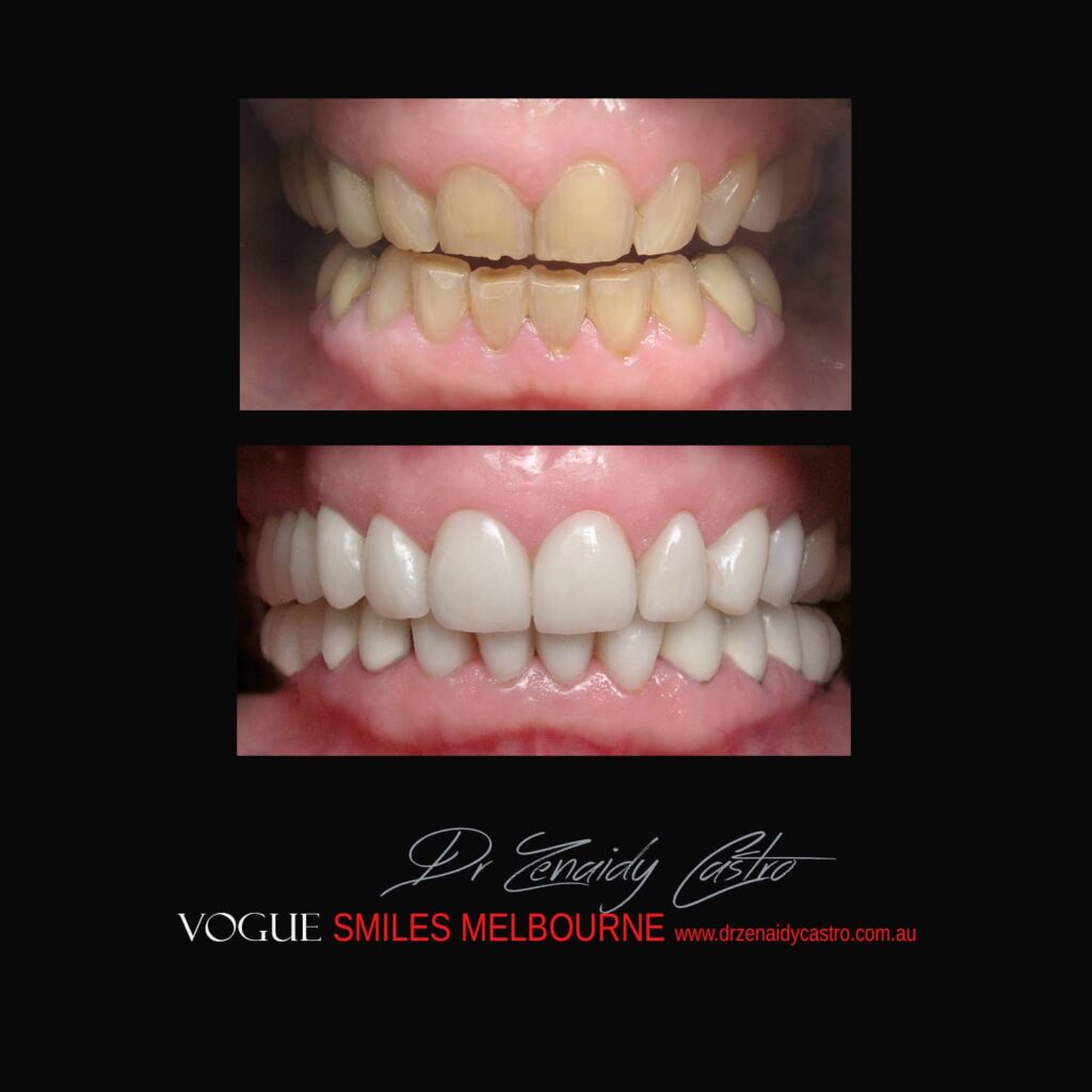 VOGUE-SMILES-COSMETIC-DENTISTRY-TREATMENT