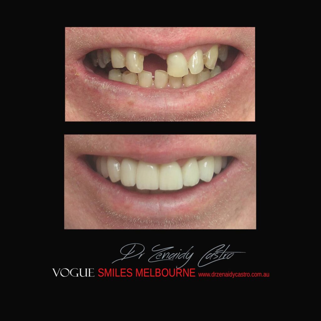 VOGUE-SMILES-COSMETIC-DENTISTRY-TREATMENT