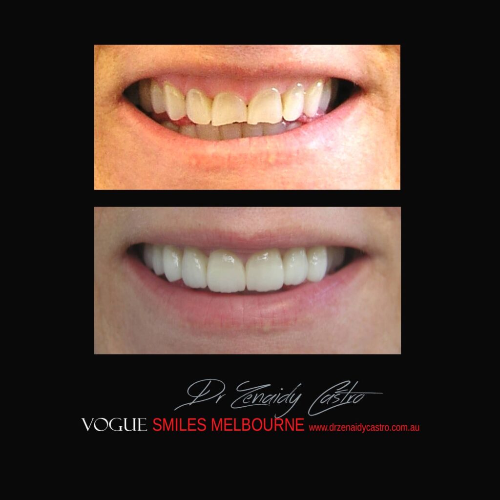 VOGUE-SMILES-COSMETIC-DENTISTRY-TREATMENT