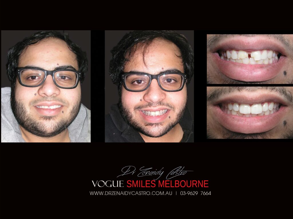 VOGUE-SMILES-COSMETIC-DENTISTRY