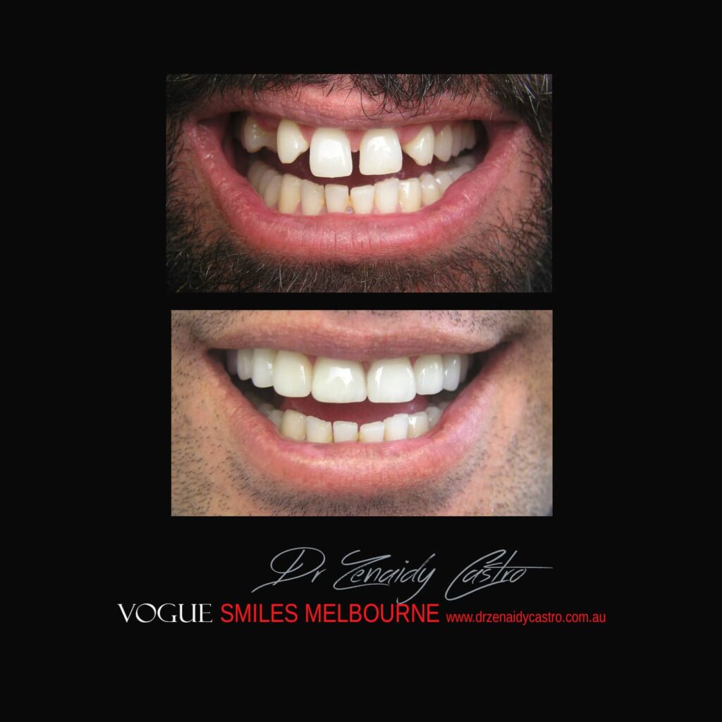 VOGUE-SMILES-COSMETIC-DENTISTRY-TREATMENT