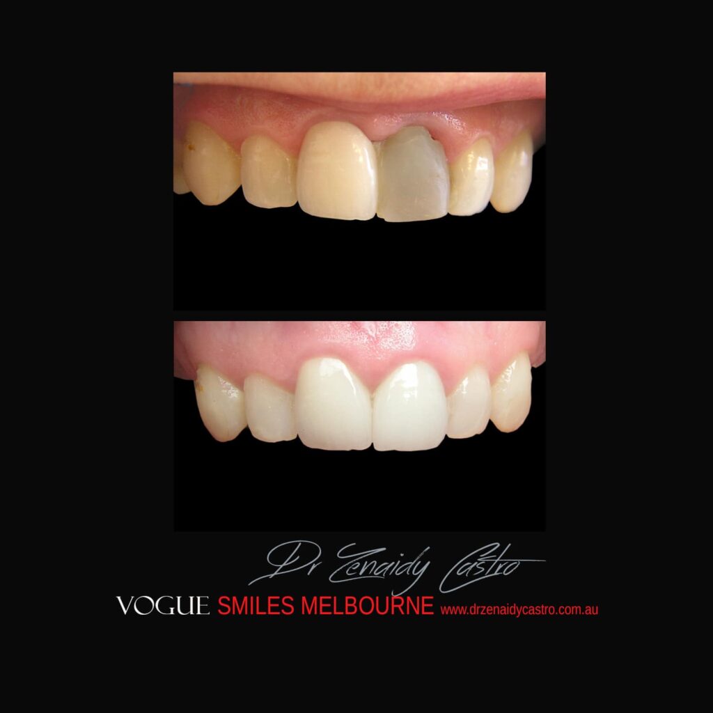 VOGUE-SMILES-COSMETIC-DENTISTRY-TREATMENT