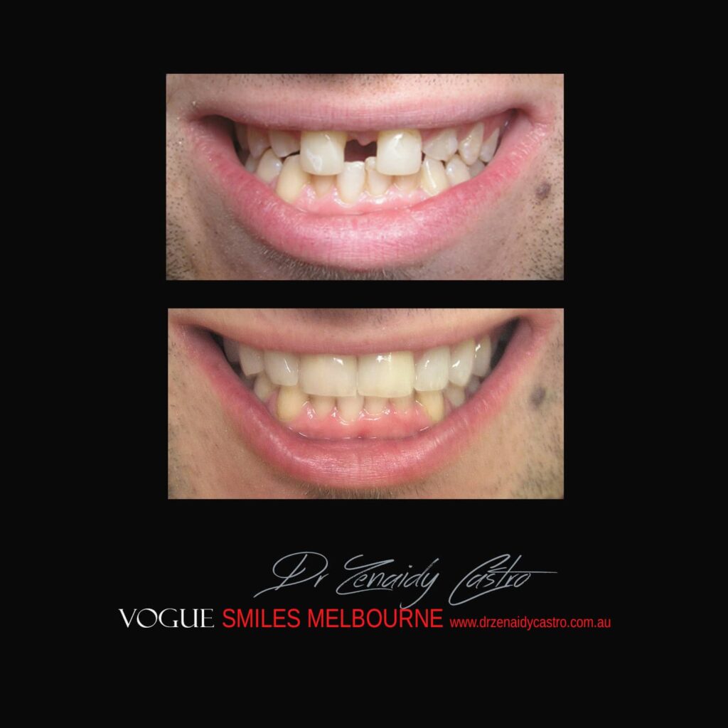 VOGUE-SMILES-COSMETIC-DENTISTRY-TREATMENT