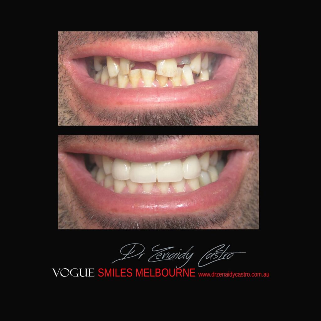 VOGUE-SMILES-COSMETIC-DENTISTRY-TREATMENT