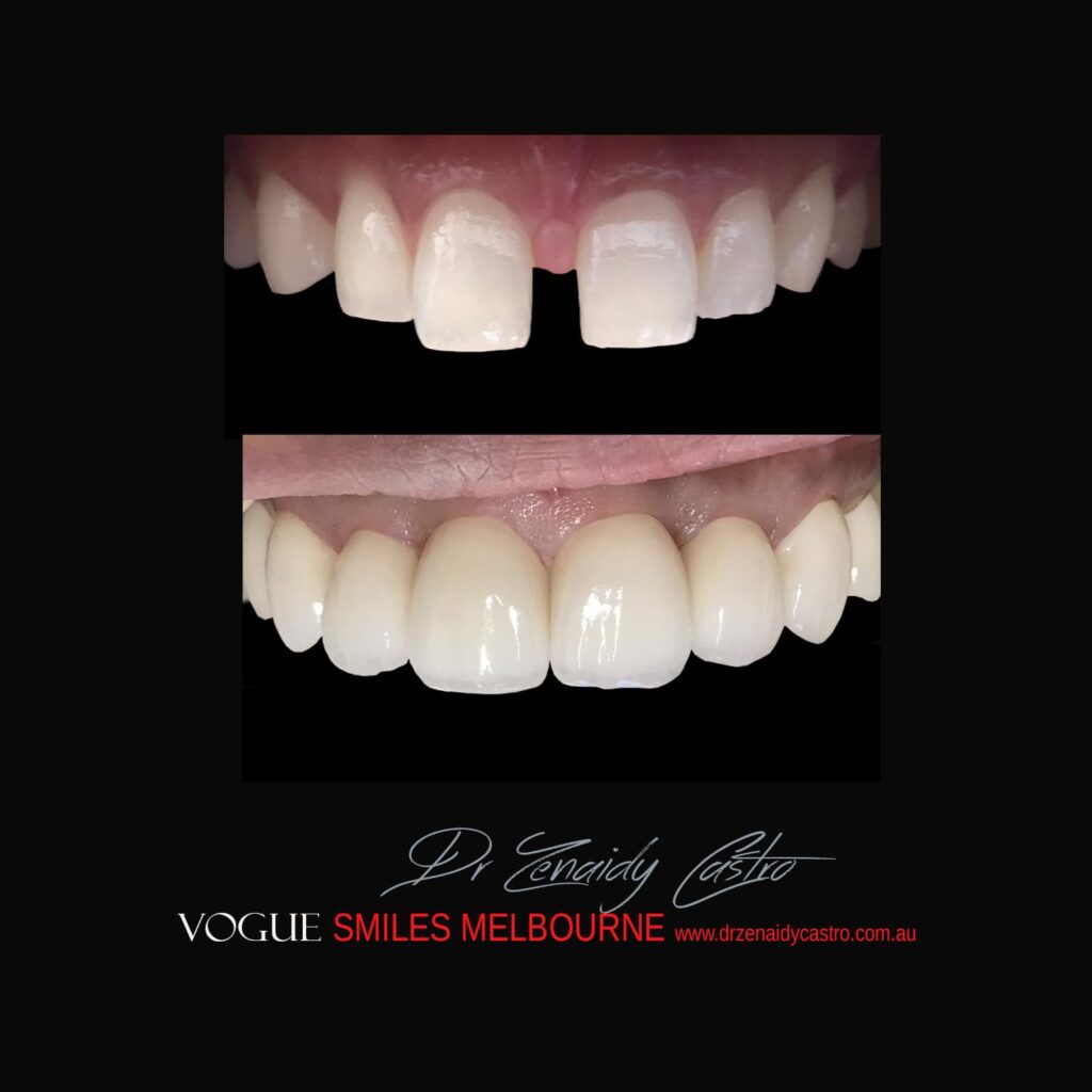 VOGUE-SMILES-COSMETIC-DENTISTRY-TREATMENT