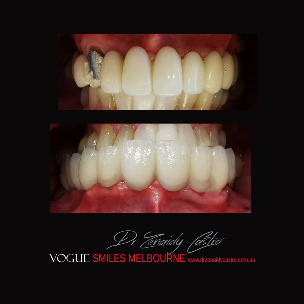 VOGUE-SMILES-COSMETIC-DENTISTRY-TREATMENT