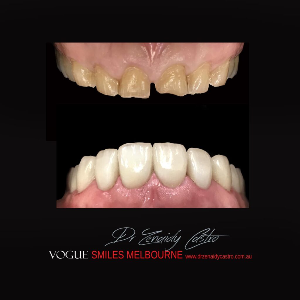 VOGUE-SMILES-COSMETIC-DENTISTRY-TREATMENT