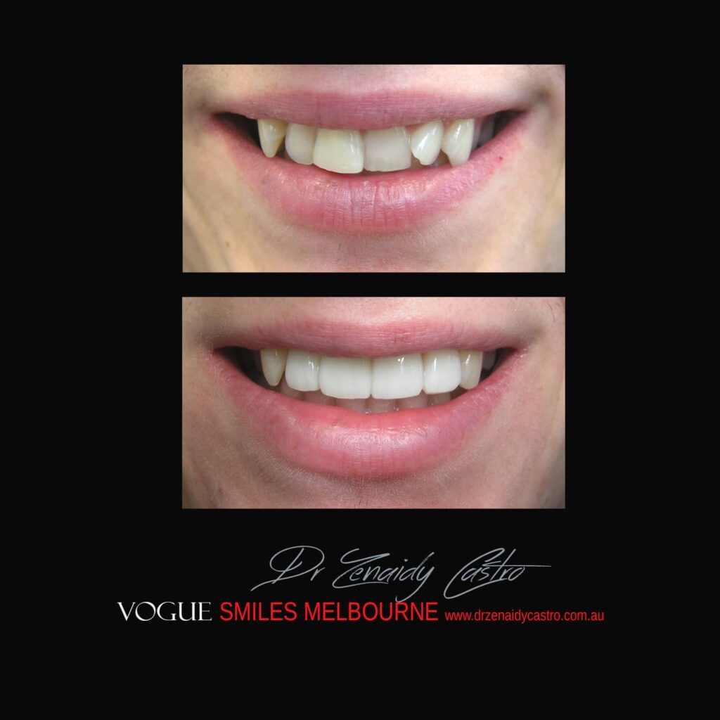 VOGUE-SMILES-COSMETIC-DENTISTRY-TREATMENT