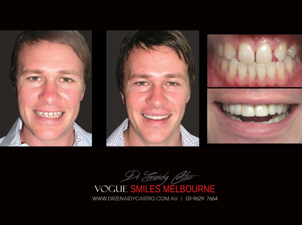 VOGUE-SMILES-COSMETIC-DENTISTRY