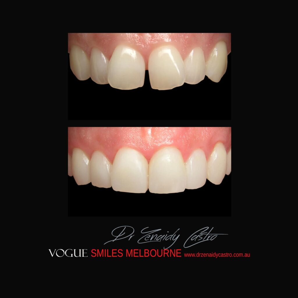 VOGUE-SMILES-COSMETIC-DENTISTRY-TREATMENT