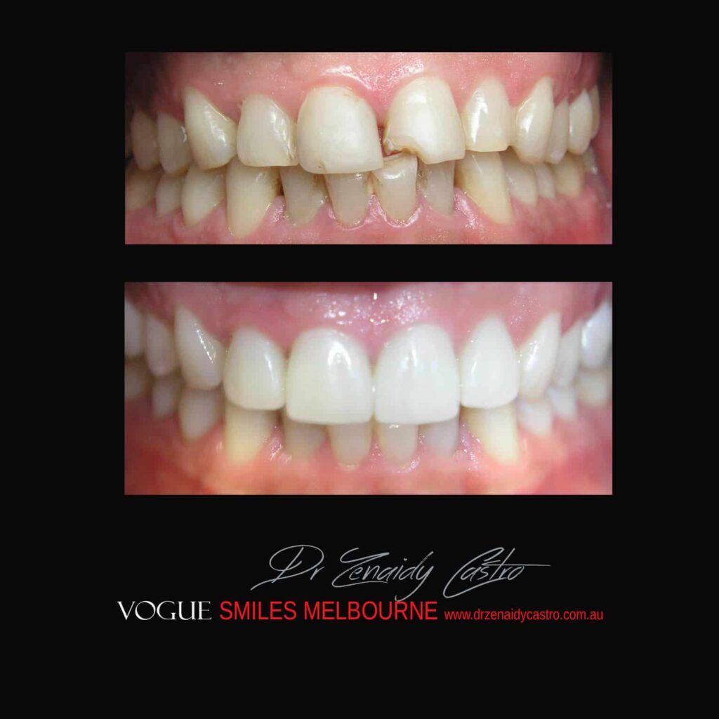 VOGUE-SMILES-COSMETIC-DENTISTRY-TREATMENT