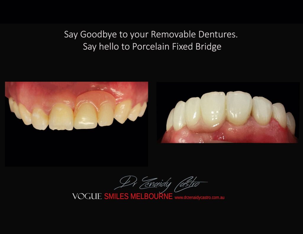 VOGUE-SMILES-COSMETIC-DENTISTRY-TREATMENT