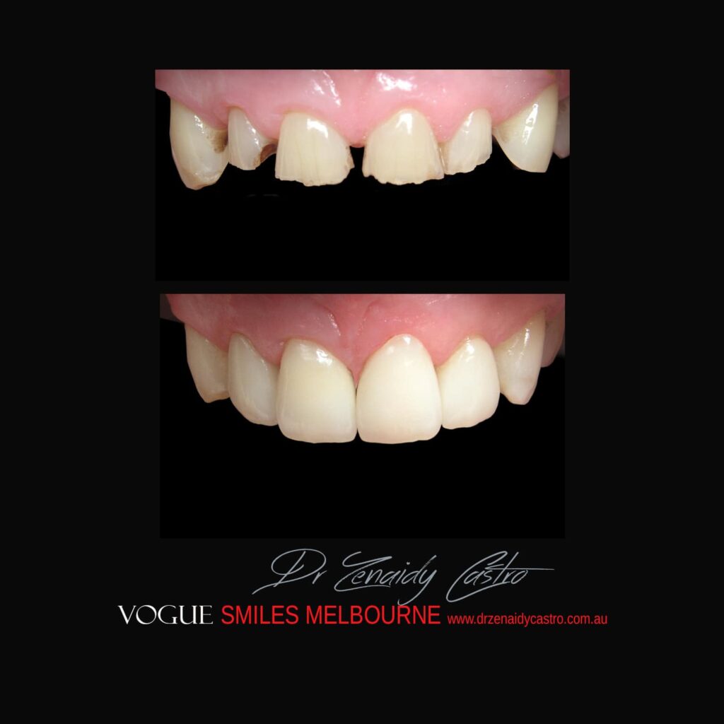 VOGUE-SMILES-COSMETIC-DENTISTRY-TREATMENT