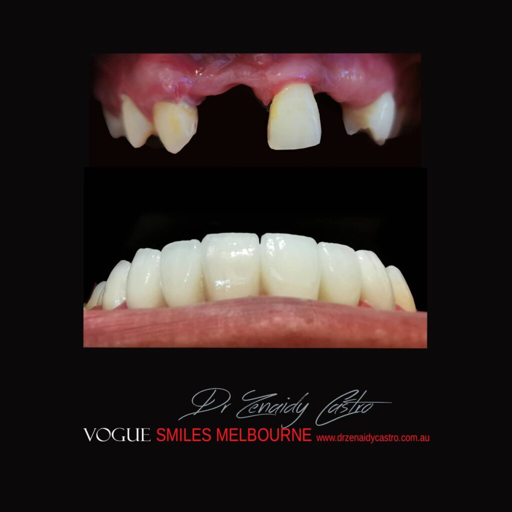 VOGUE-SMILES-COSMETIC-DENTISTRY-TREATMENT