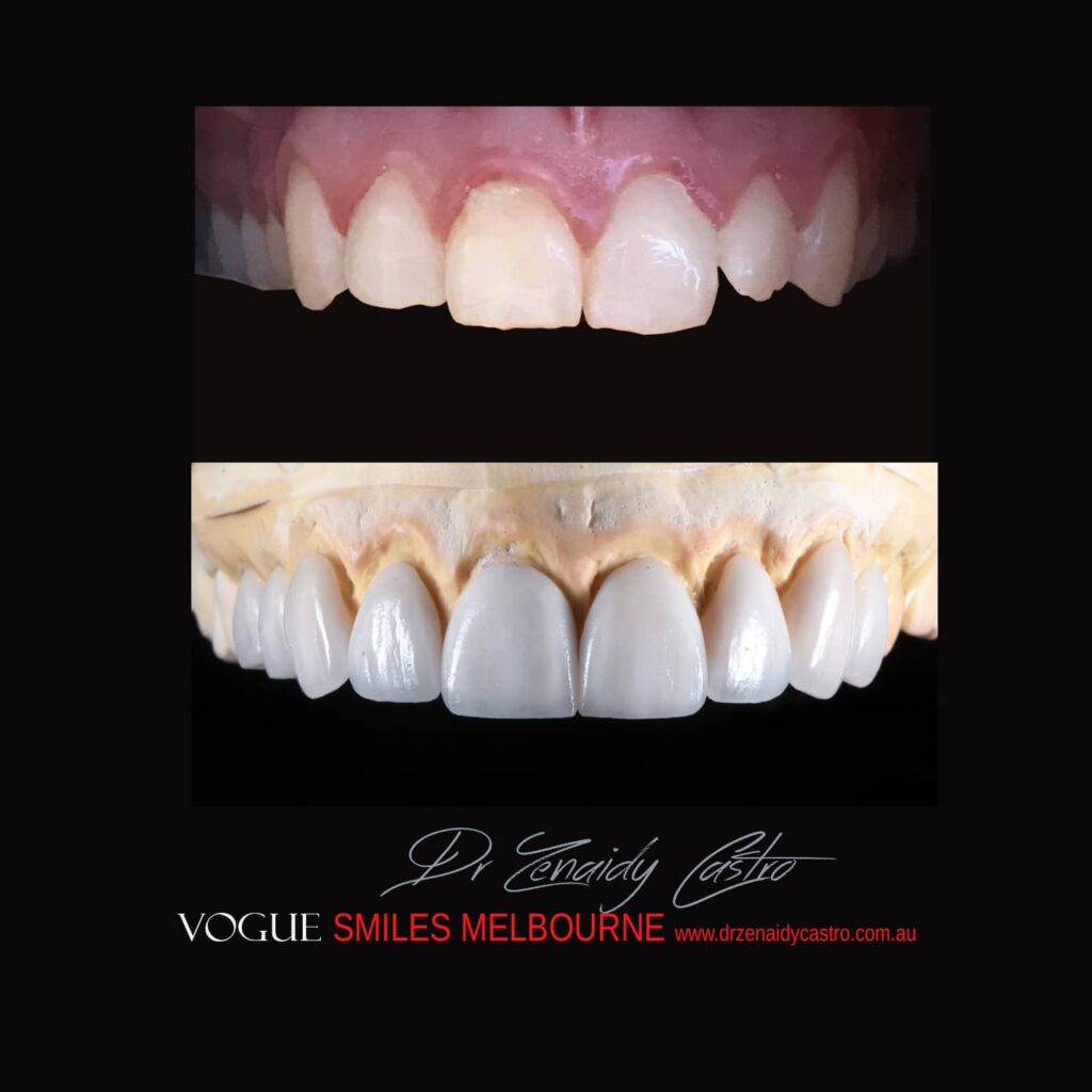 VOGUE-SMILES-COSMETIC-DENTISTRY-TREATMENT