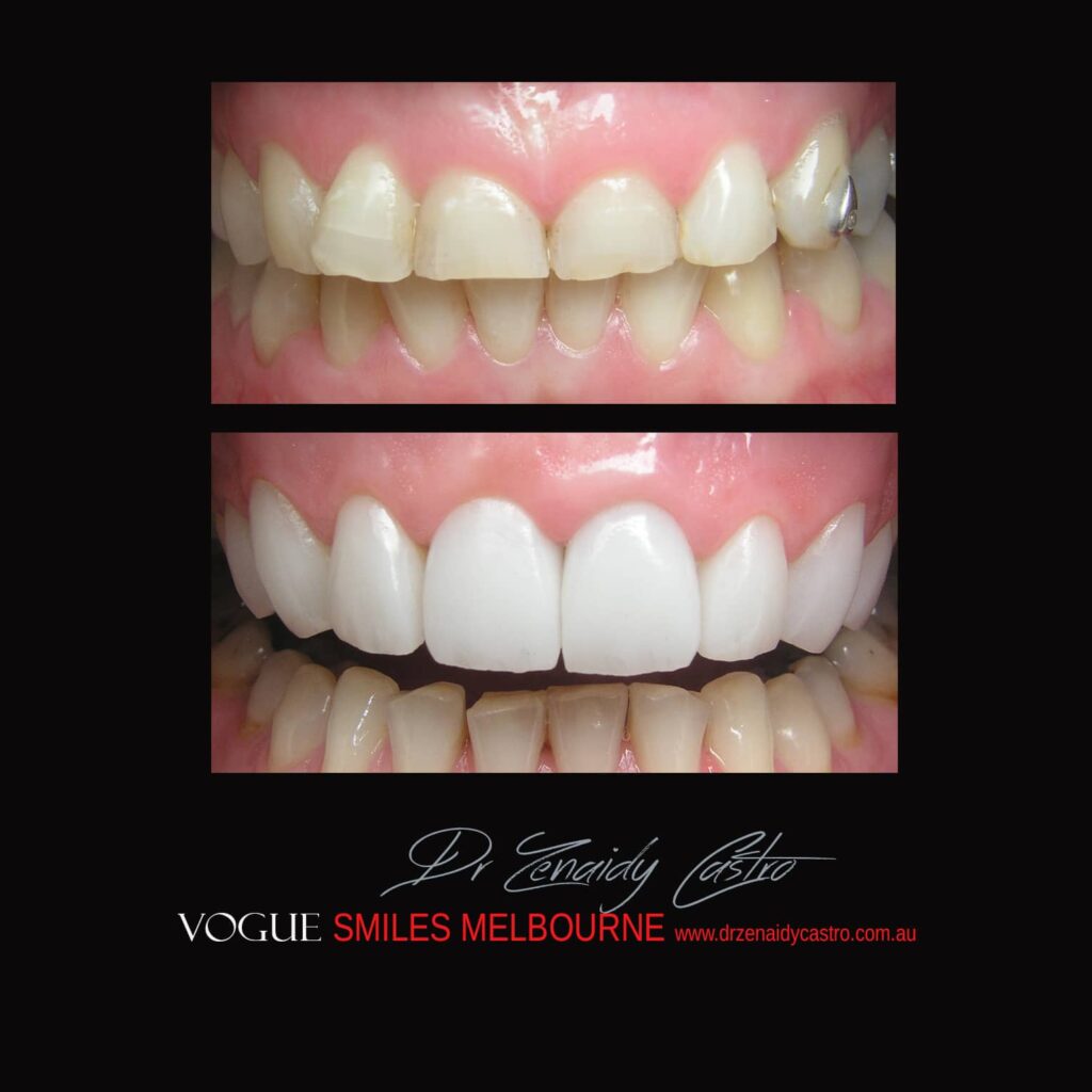VOGUE-SMILES-COSMETIC-DENTISTRY-TREATMENT
