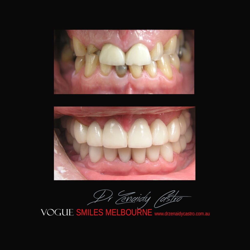 VOGUE-SMILES-COSMETIC-DENTISTRY-TREATMENT