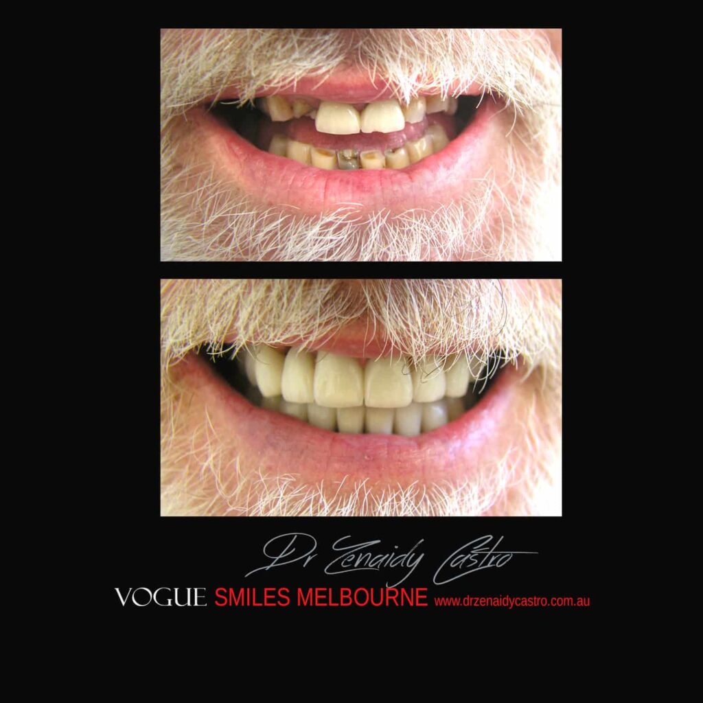 VOGUE-SMILES-COSMETIC-DENTISTRY-TREATMENT