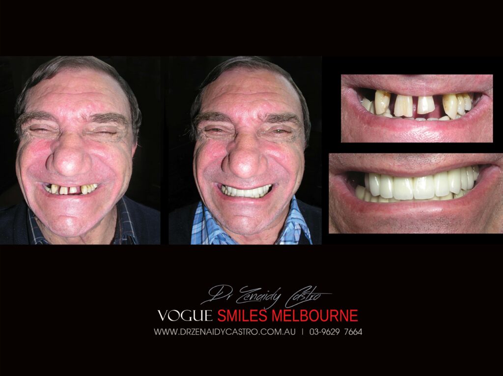 VOGUE-SMILES-COSMETIC-DENTISTRY