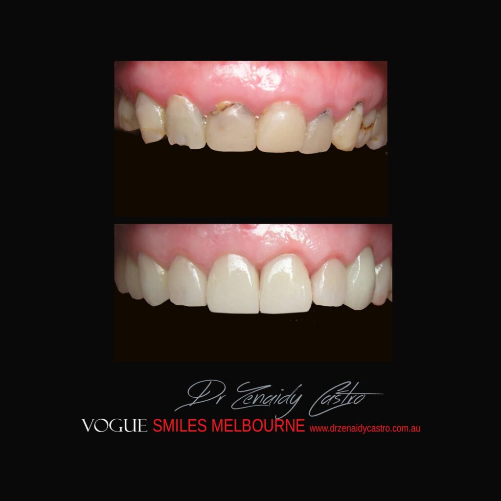 VOGUE-SMILES-COSMETIC-DENTISTRY-TREATMENTVOGUE-SMILES-COSMETIC-DENTISTRY-TREATMENT