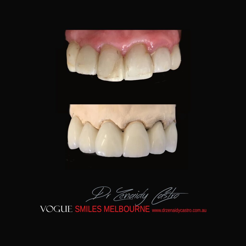 VOGUE-SMILES-COSMETIC-DENTISTRY