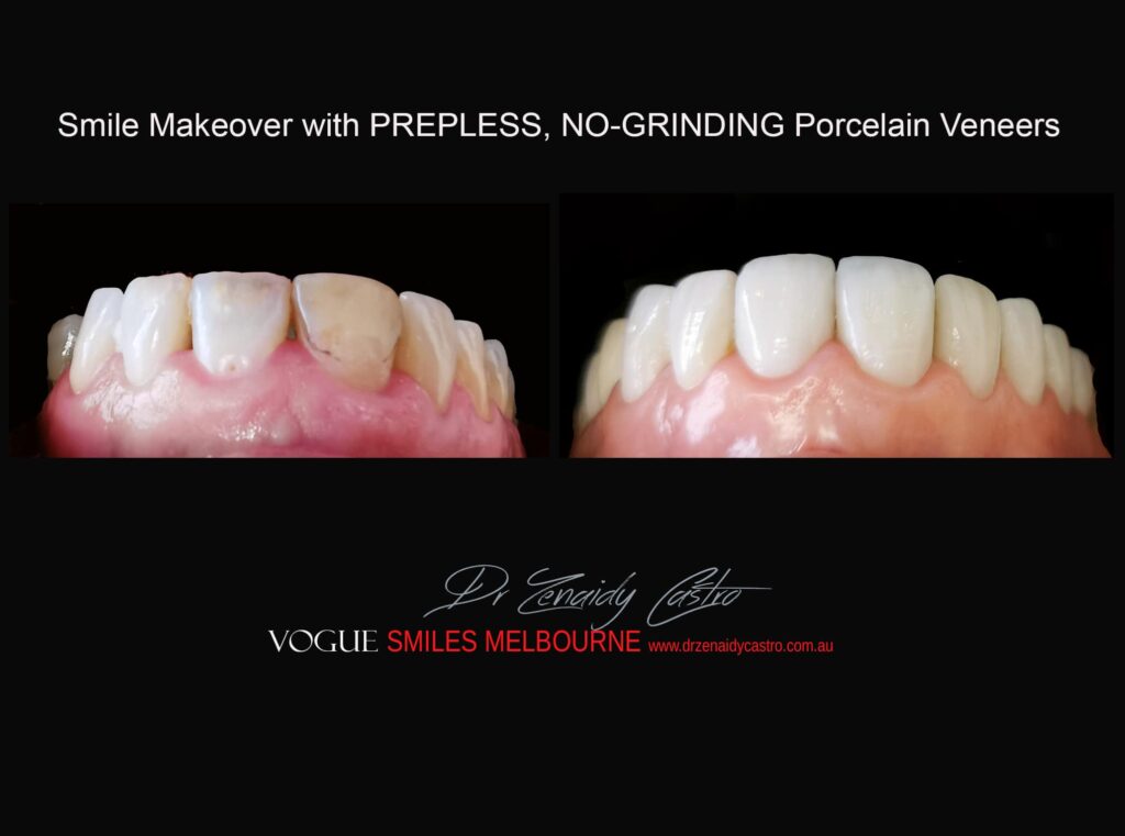 VOGUE-SMILES-COSMETIC-DENTISTRY