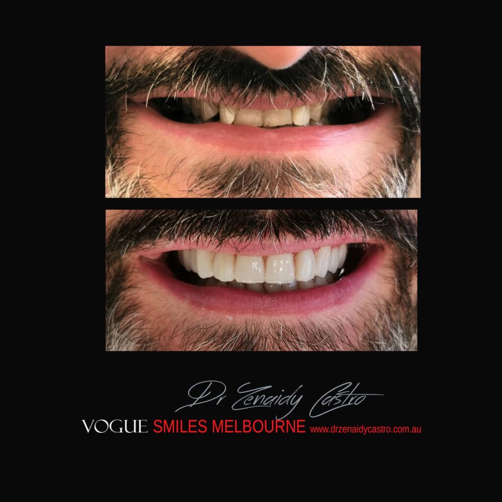 VOGUE-SMILES-COSMETIC-DENTISTRY